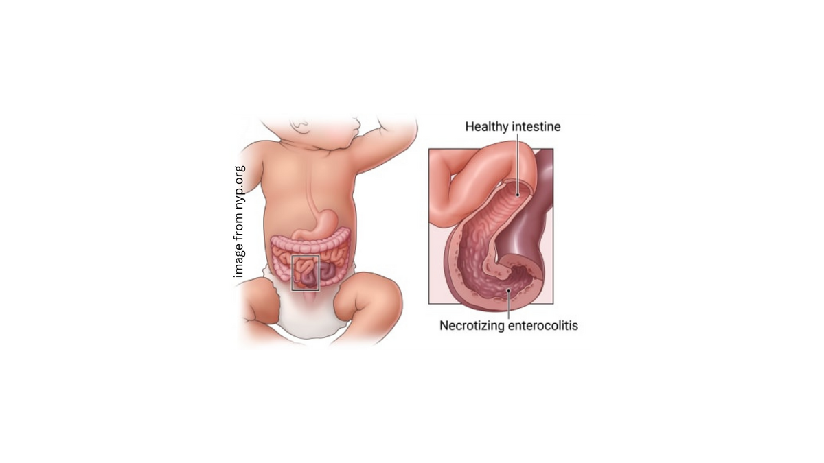Image of a baby with gastrointestinal tract highlighted